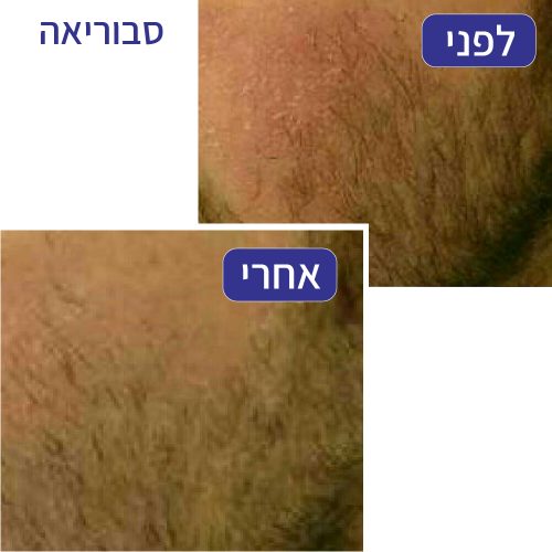 סבוריאה | חני רוזנברג