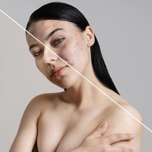 before-after-portrait-woman-retouched