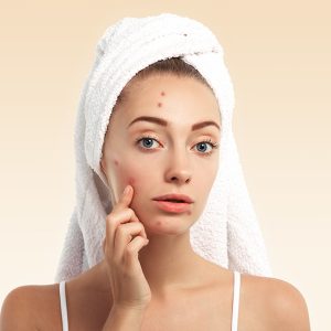 Close up isolated portrait of beautiful young Caucasian woman with blue eyes and problem skin, looking at the camera, pointing at pimple wearing white towel on her head against blue studio background