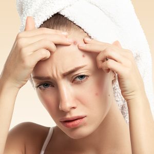 Headshot of displeased young blond woman with towel on her head, looking with painful face at the camera while squeezing pimple on her forehead. Portrait of Caucasian girl against blue wall background